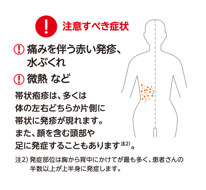 帯状疱疹の注意すべき症状